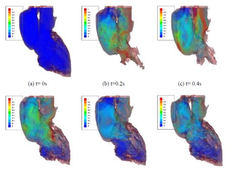 heart cfd